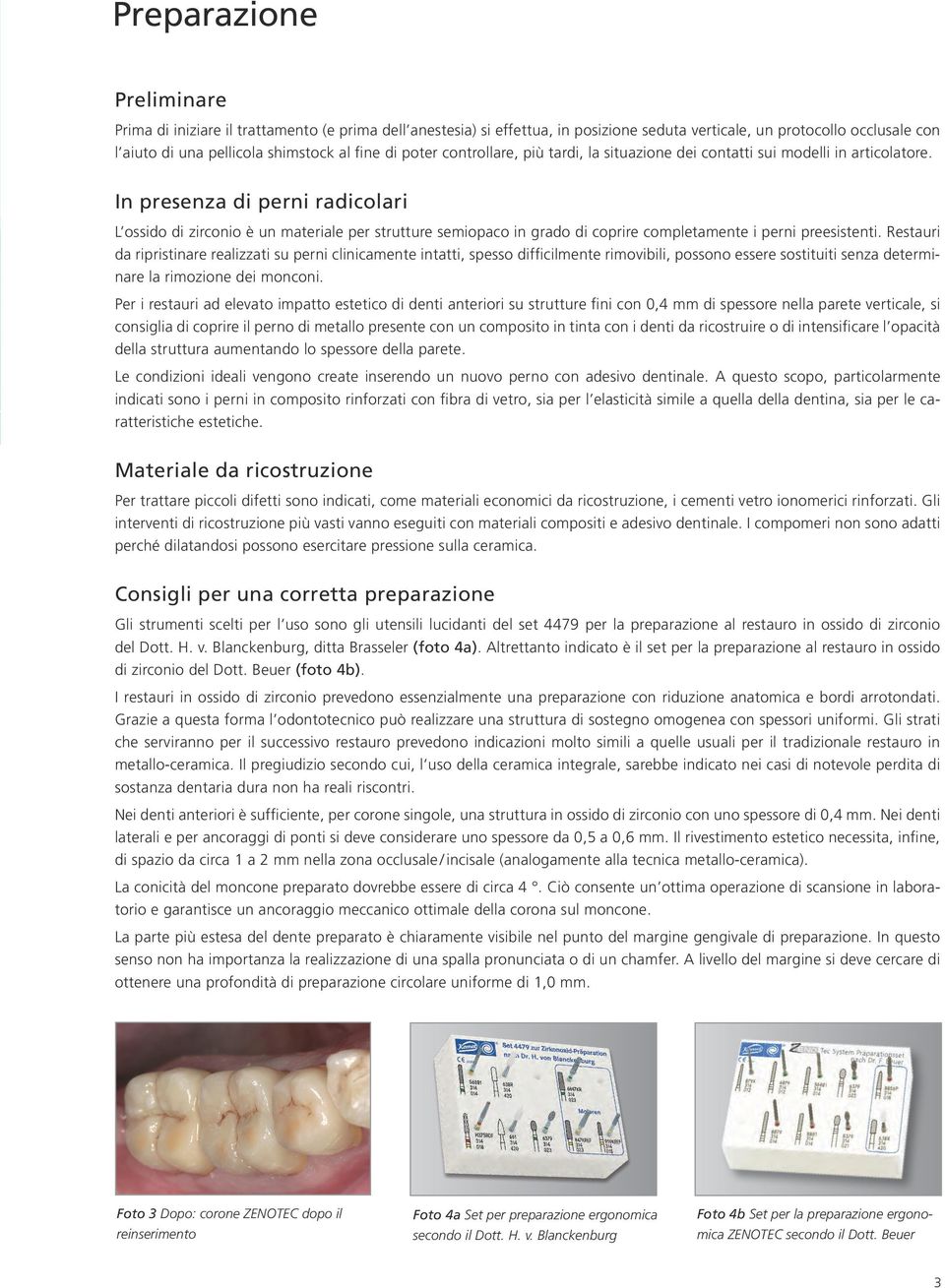 In presenza di perni radicolari L ossido di zirconio è un materiale per strutture semiopaco in grado di coprire completamente i perni preesistenti.