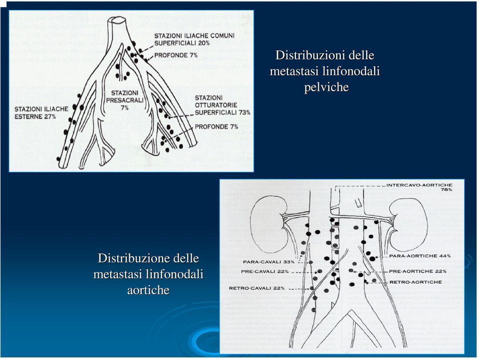 pelviche Distribuzione