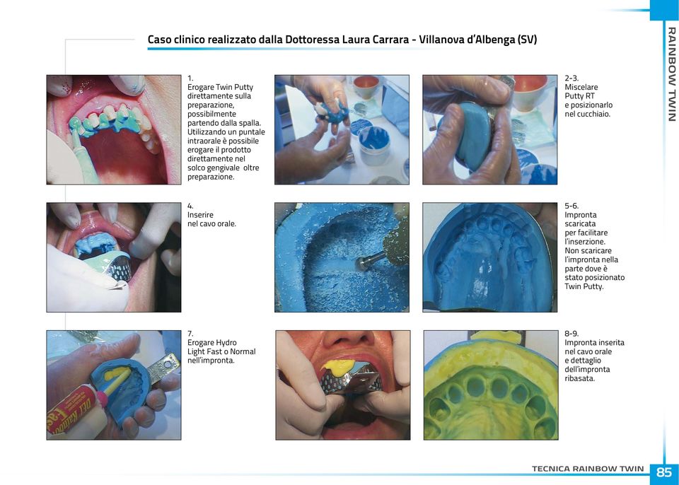 Utilizzando un puntale intraorale è possibile erogare il prodotto direttamente nel solco gengivale oltre preparazione. 2-3.