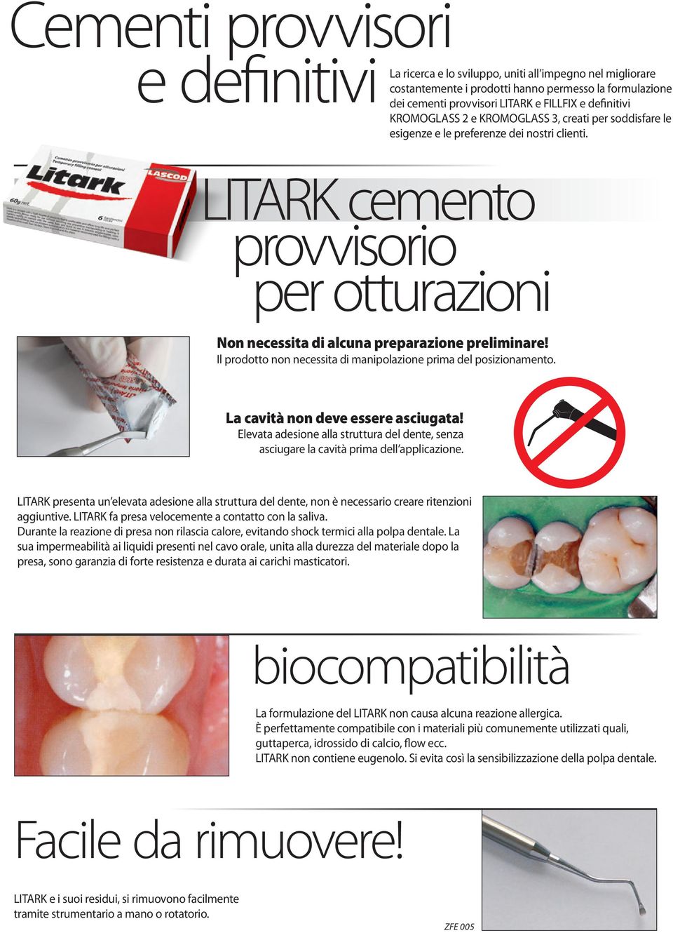 Il prodotto non necessita di manipolazione prima del posizionamento. La cavità non deve essere asciugata! Elevata adesione alla struttura del dente, senza asciugare la cavità prima dell applicazione.