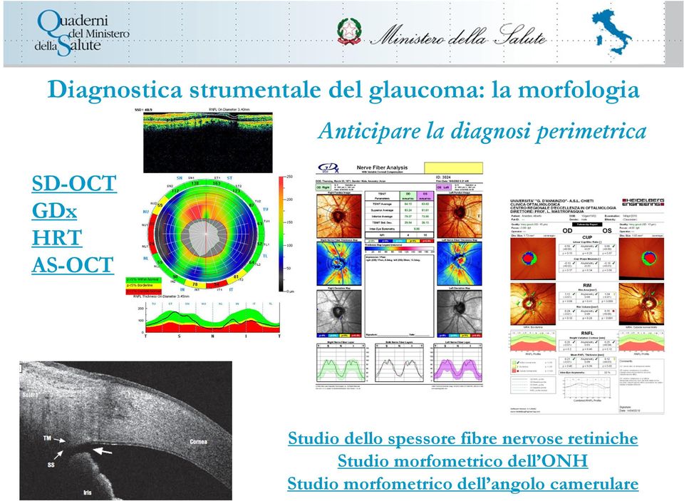 Studio dello spessore fibre nervose retiniche Studio