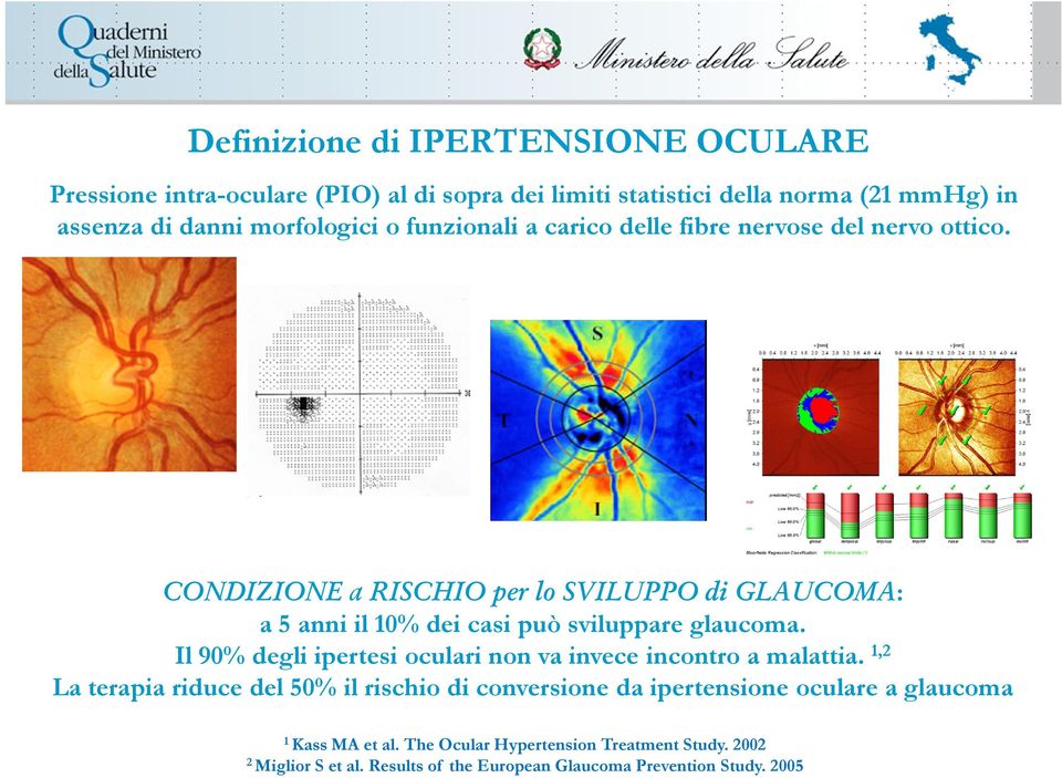 CONDIZIONE a RISCHIO per lo SVILUPPO di GLAUCOMA: a 5 anni il 10% dei casi può sviluppare glaucoma.