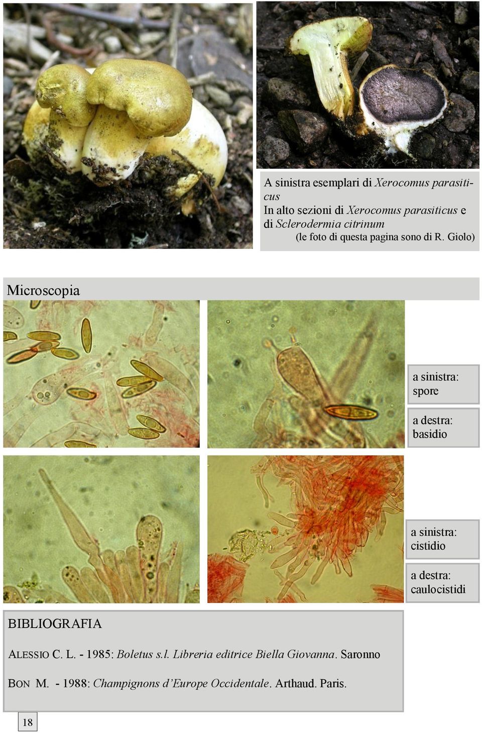 Giolo) Microscopia a sinistra: spore a destra: basidio a sinistra: cistidio a destra: caulocistidi
