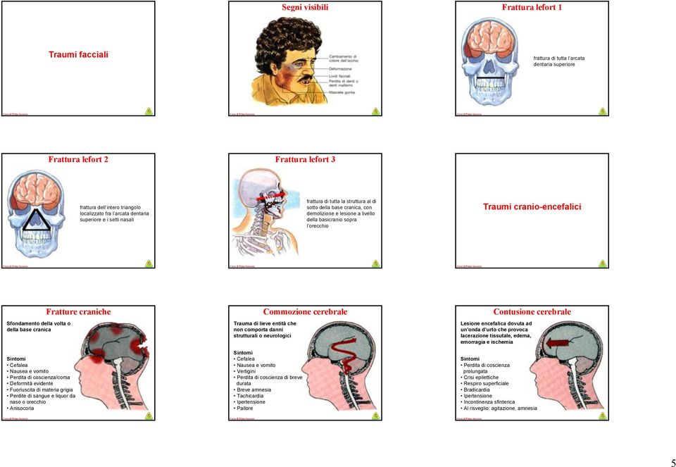 della volta o della base cranica Cefalea Nausea e vomito Perdita di coscienza/coma Deformità evidente Fuoriuscita di materia grigia Perdite di sangue e liquor da naso o orecchio Anisocoria Fratture