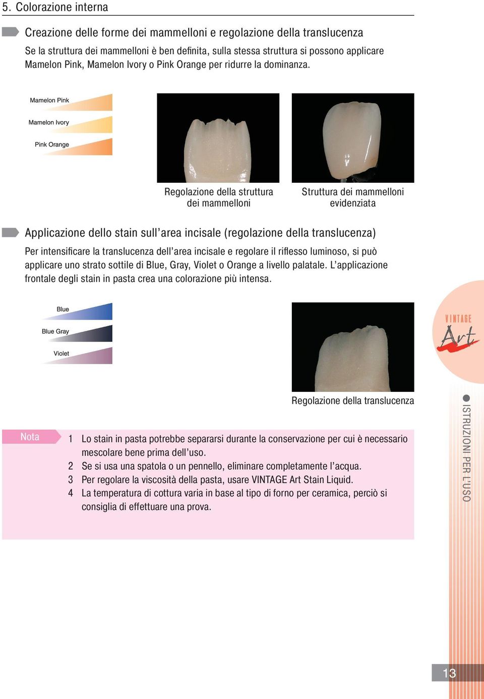 Regolazione della struttura dei mammelloni Struttura dei mammelloni evidenziata Applicazione dello stain sull area incisale (regolazione della translucenza) Per intensifi care la translucenza dell