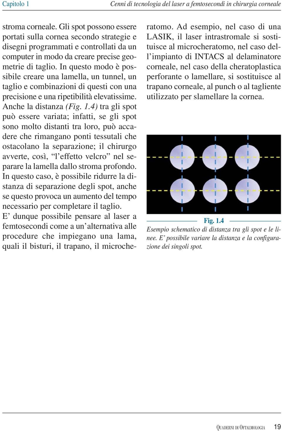 In questo modo è possibile creare una lamella, un tunnel, un taglio e combinazioni di questi con una precisione e una ripetibilità elevatissime. Anche la distanza (Fig. 1.