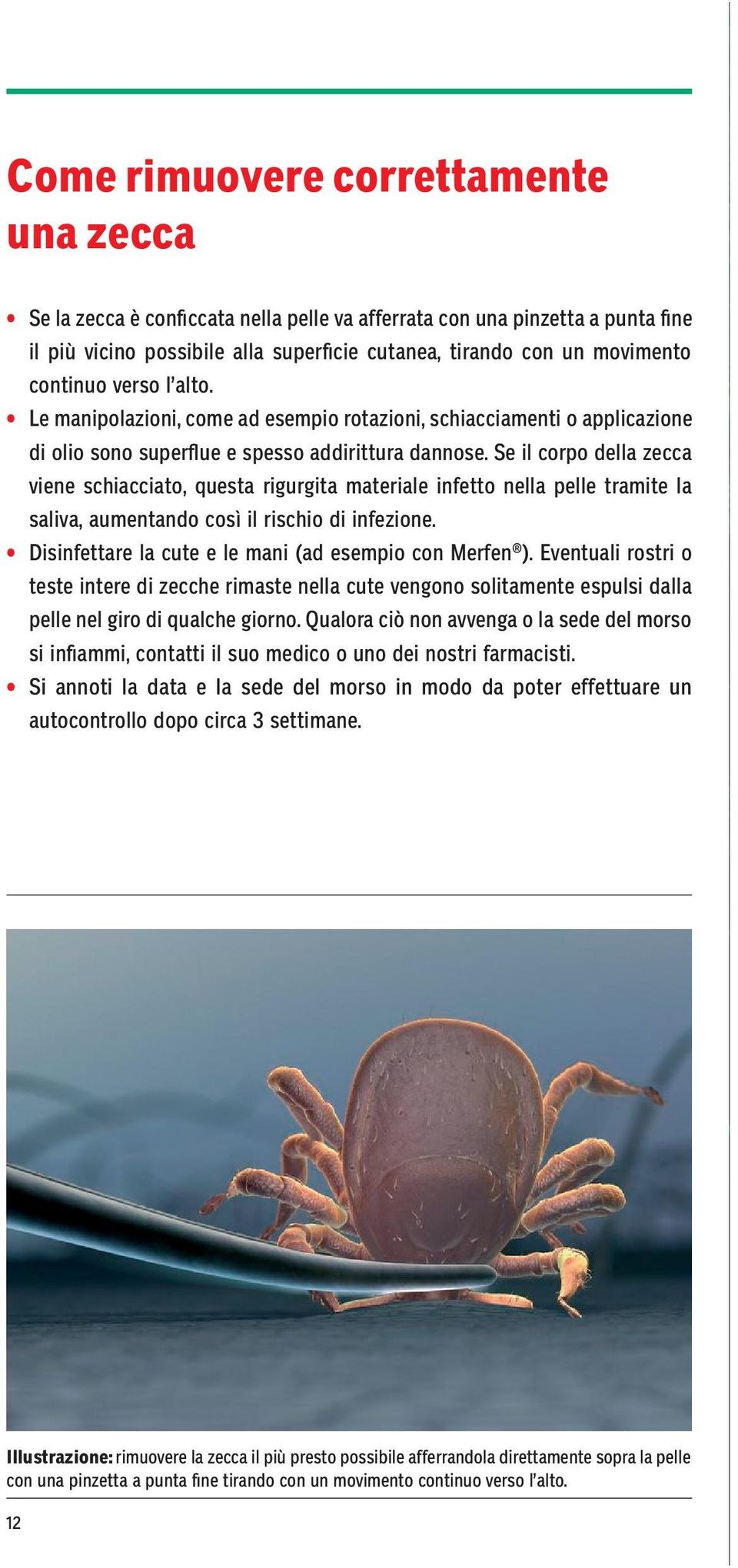 Se il corpo della zecca viene schiacciato, questa rigurgita materiale infetto nella pelle tramite la saliva, aumentando così il rischio di infezione.