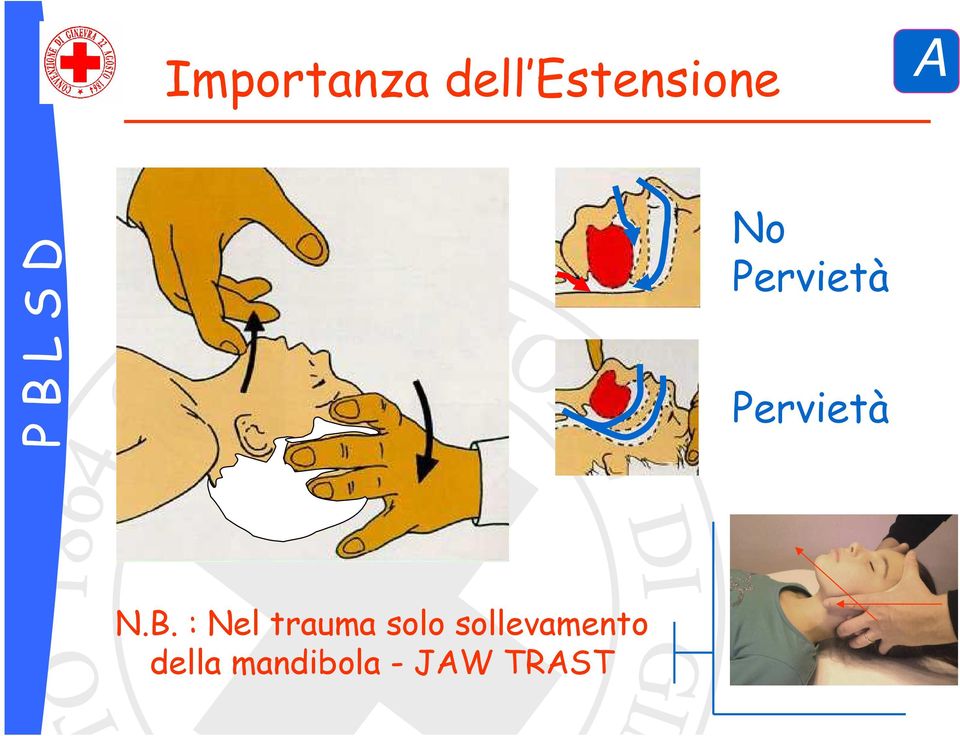 : Nel trauma solo