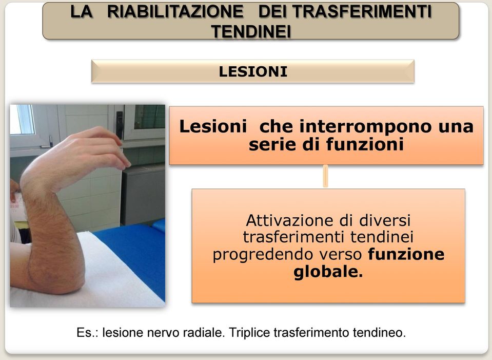 tendinei progredendo verso funzione globale. Es.