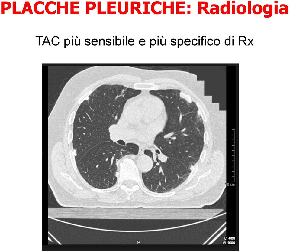 Radiologia TAC