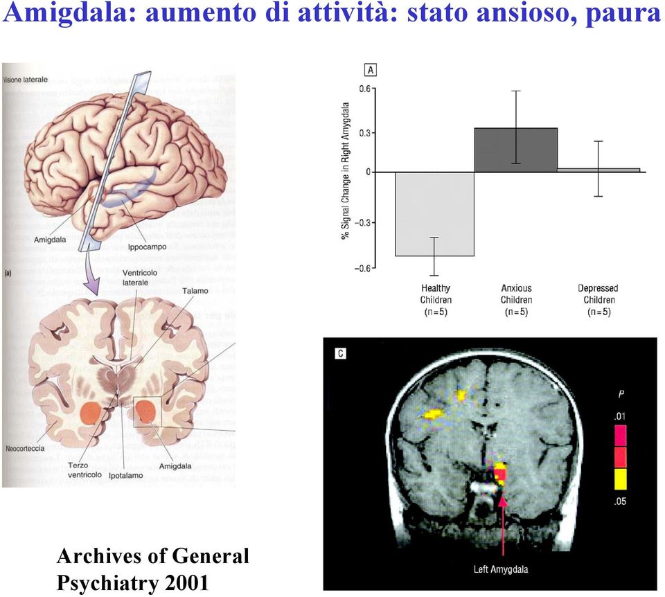 ansioso, paura