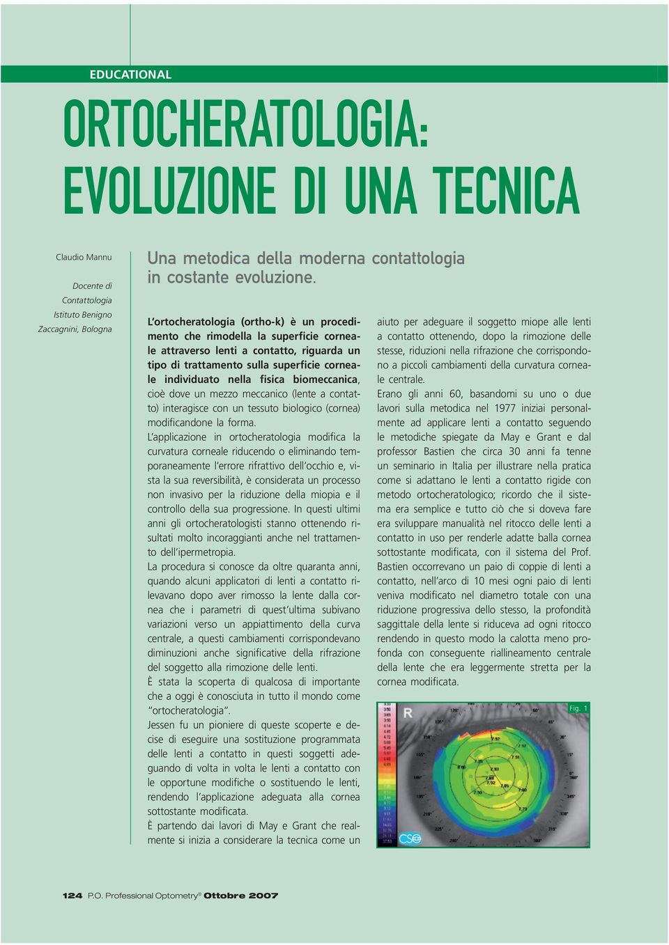 biomeccanica, cioè dove un mezzo meccanico (lente a contatto) interagisce con un tessuto biologico (cornea) modificandone la forma.