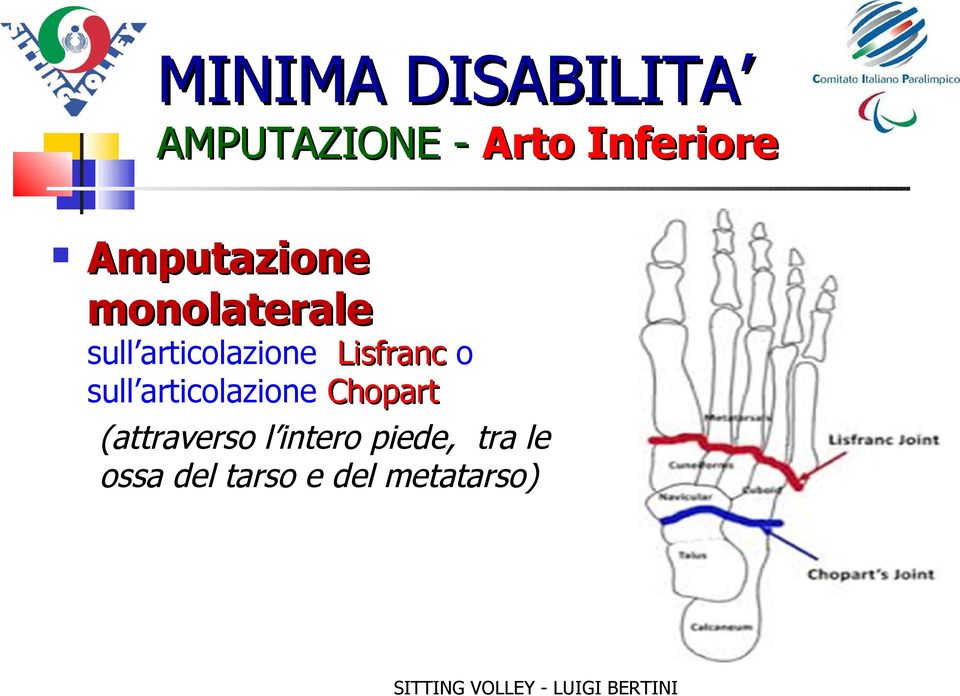 Lisfranc o sull articolazione Chopart