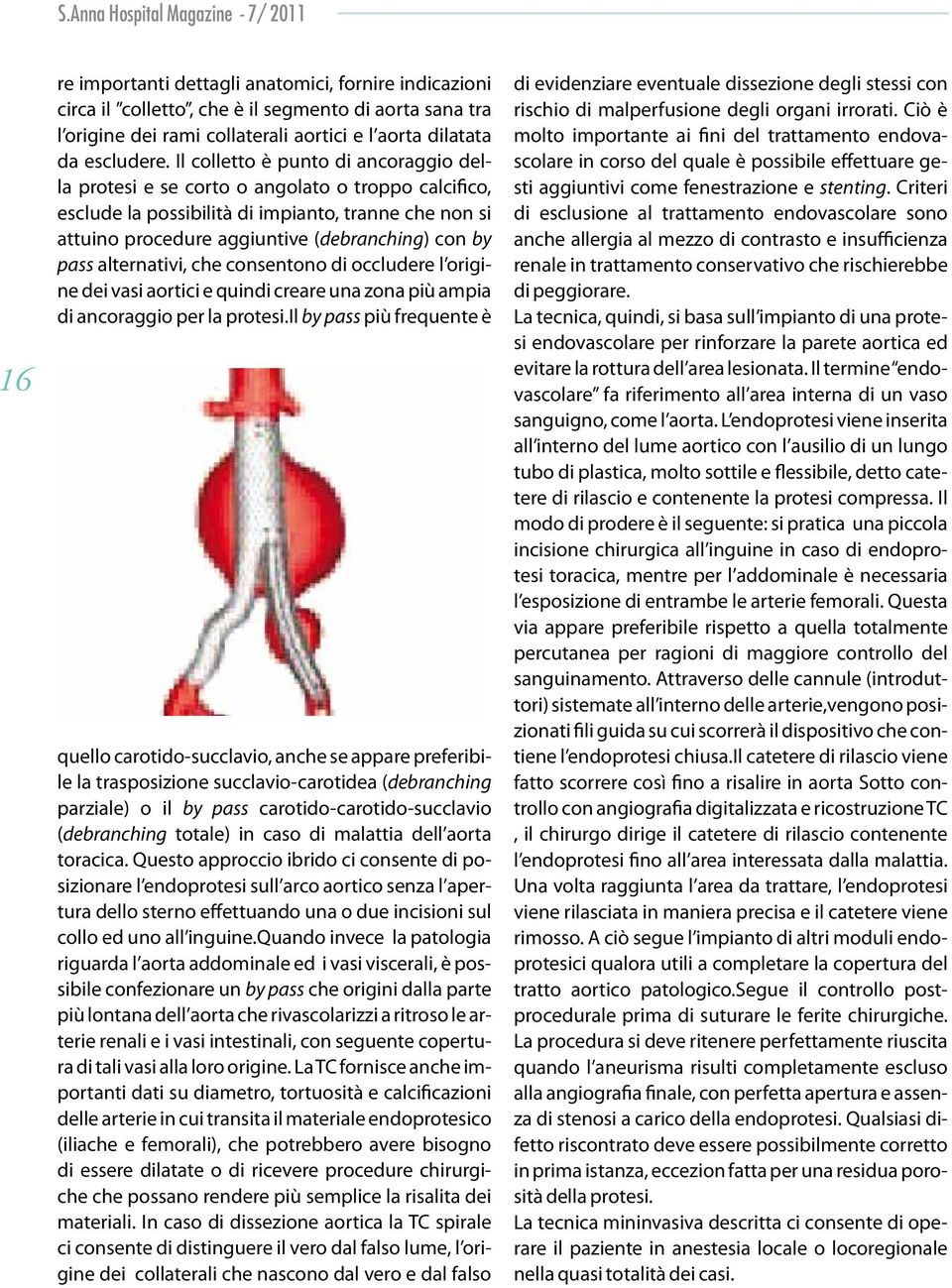 Il colletto è punto di ancoraggio della protesi e se corto o angolato o troppo calcifico, esclude la possibilità di impianto, tranne che non si attuino procedure aggiuntive (debranching) con by pass