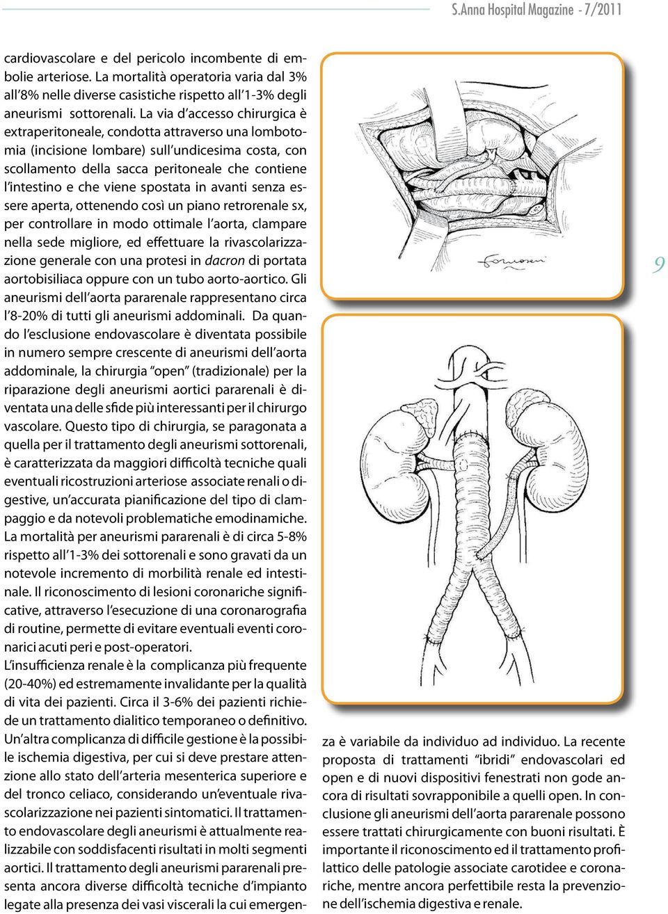 viene spostata in avanti senza essere aperta, ottenendo così un piano retrorenale sx, per controllare in modo ottimale l aorta, clampare nella sede migliore, ed effettuare la rivascolarizzazione