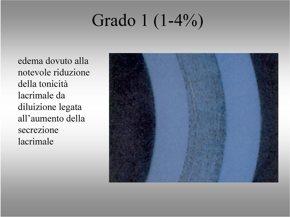 lacrimale da diluizione legata