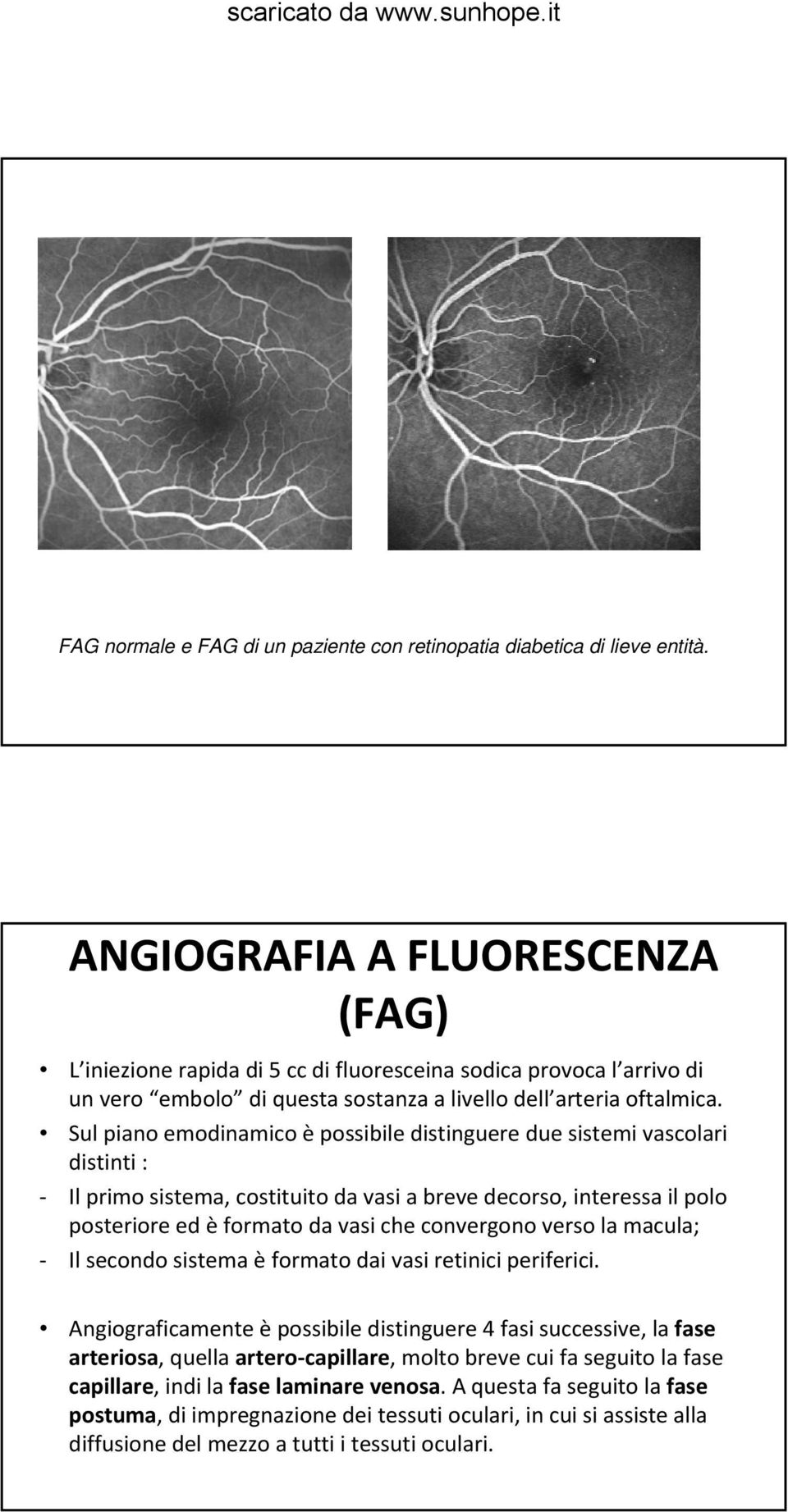 Sul piano emodinamico è possibile distinguere due sistemi vascolari distinti : Il primo sistema, costituito da vasi a breve decorso, interessa il polo posteriore ed èformato da vasi che convergono