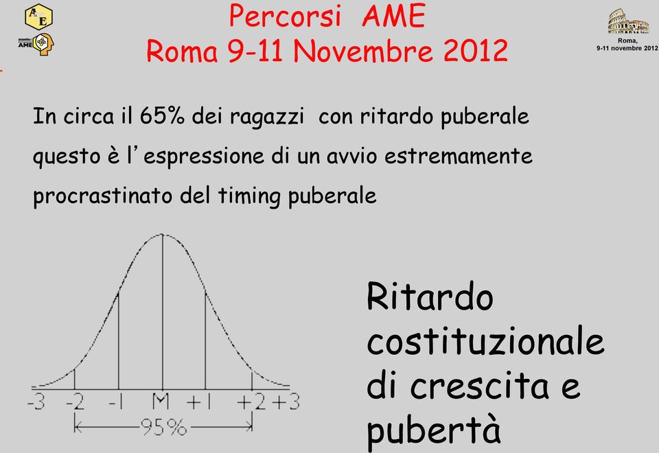 estremamente procrastinato del timing