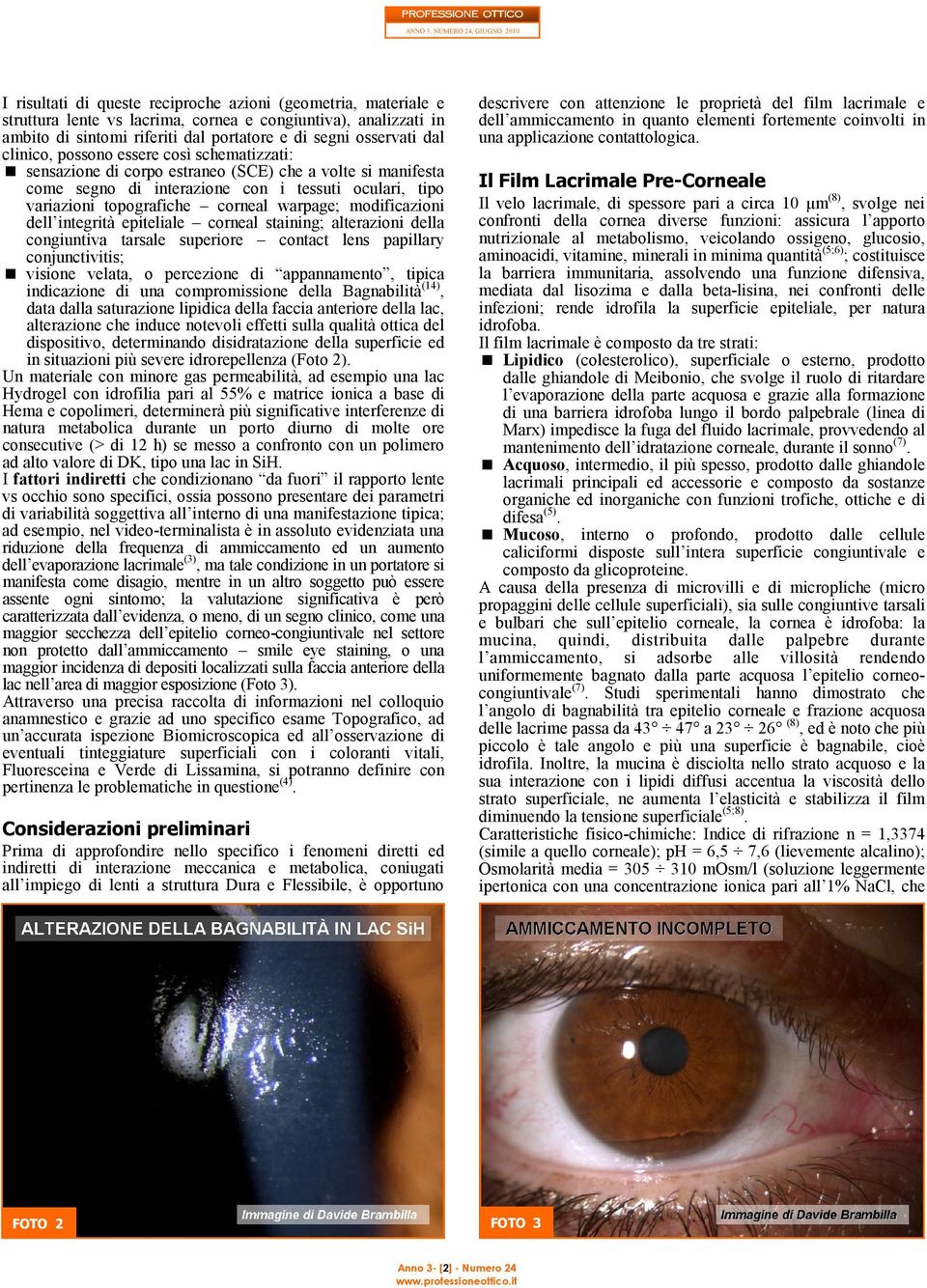 modificazioni dell integrità epiteliale corneal staining; alterazioni della congiuntiva tarsale superiore contact lens papillary conjunctivitis; visione velata, o percezione di appannamento, tipica