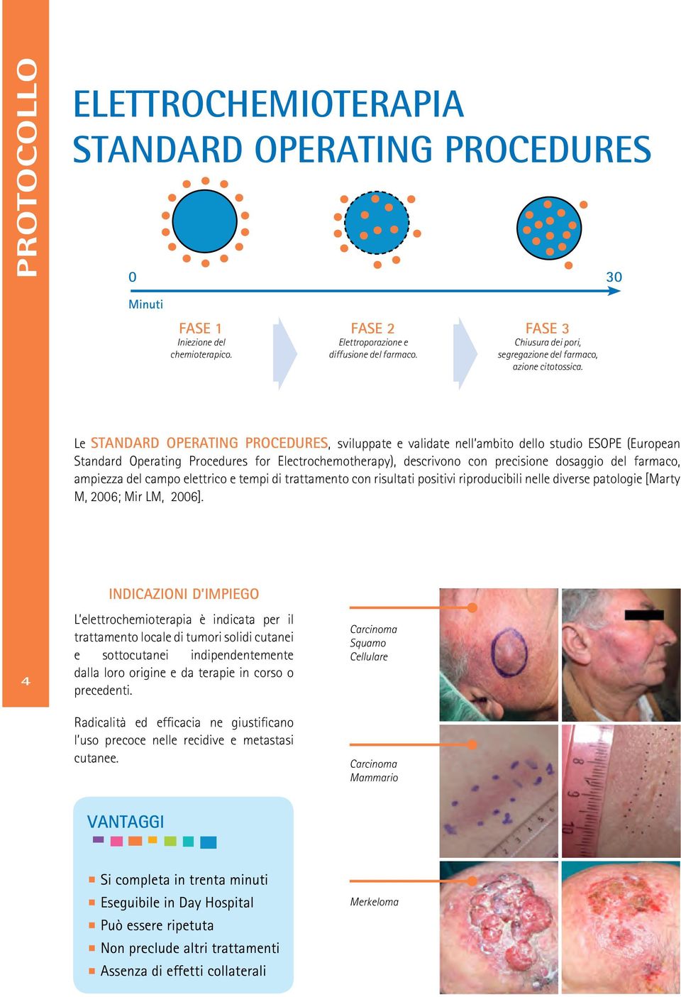 Le STANDARD OPERATING PROCEDURES, sviluppate e validate nell ambito dello studio ESOPE (European Standard Operating Procedures for Electrochemotherapy), descrivono con precisione dosaggio del