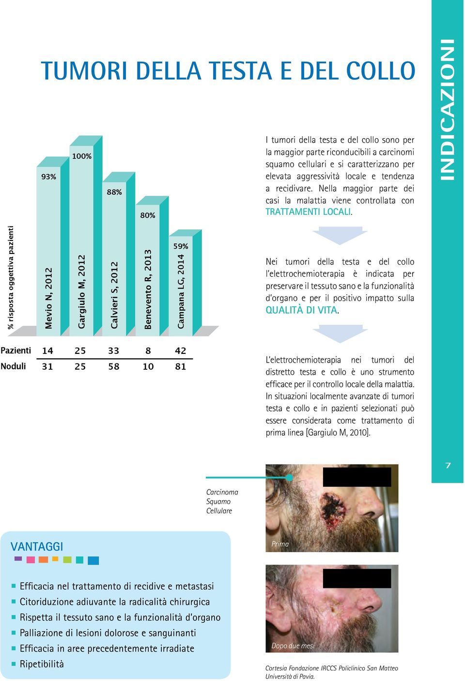 INDICAZIONI % risposta oggettiva pazienti Mevio N, 2012 Gargiulo M, 2012 Calvieri S, 2012 Benevento R, 2013 59% Campana LG, 2014 Nei tumori della testa e del collo l elettrochemioterapia è indicata