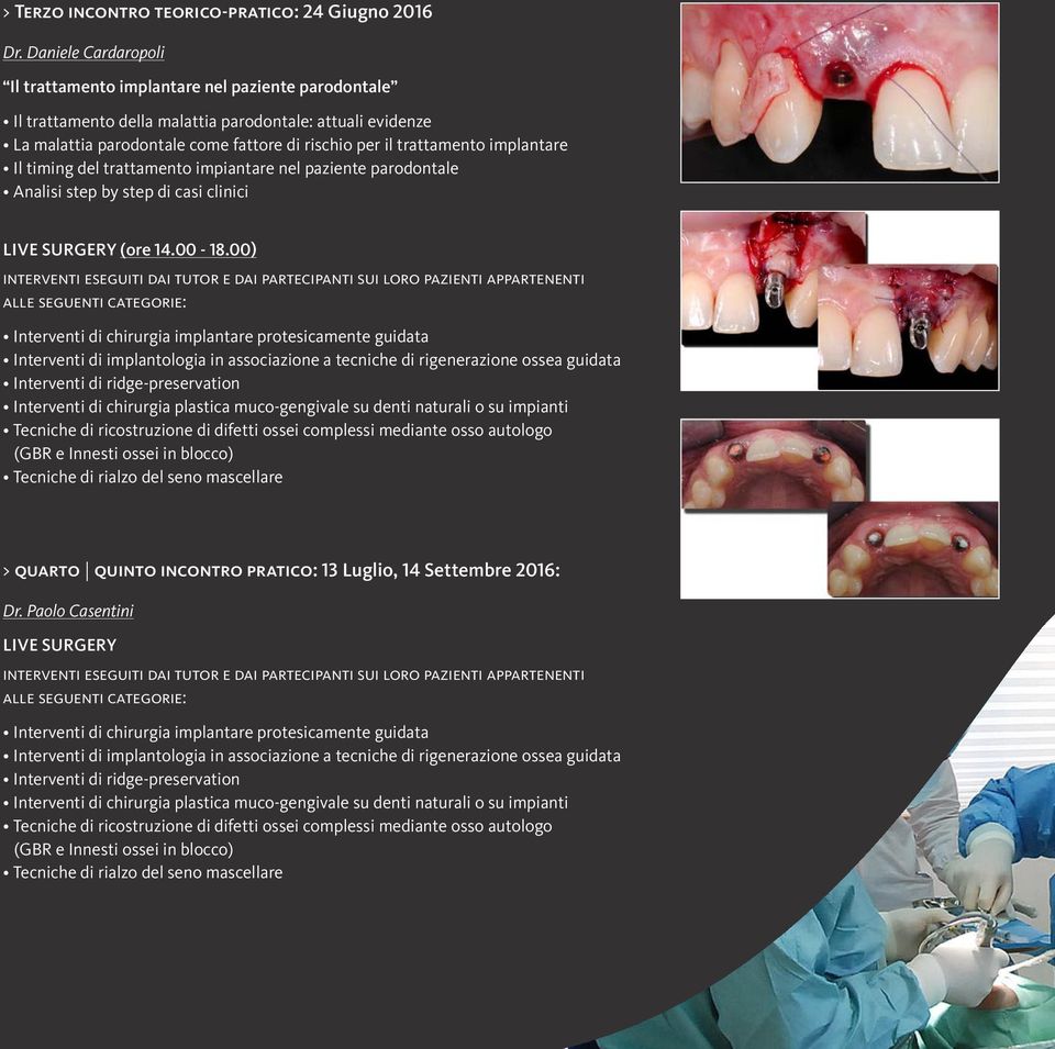 implantare Il timing del trattamento impiantare nel paziente parodontale Analisi step by step di casi clinici LIVE SURGERY (ore 14.00-18.