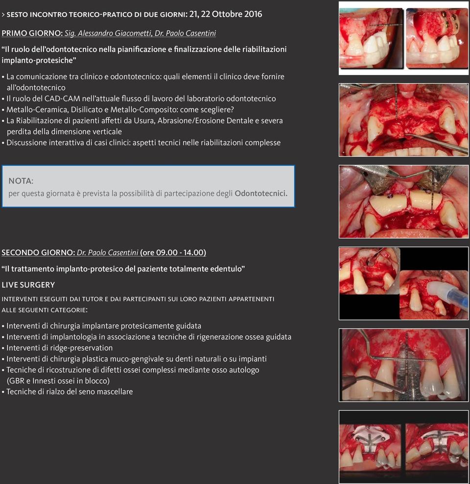 fornire all odontotecnico Il ruolo del CAD-CAM nell attuale flusso di lavoro del laboratorio odontotecnico Metallo-Ceramica, Disilicato e Metallo-Composito: come scegliere?