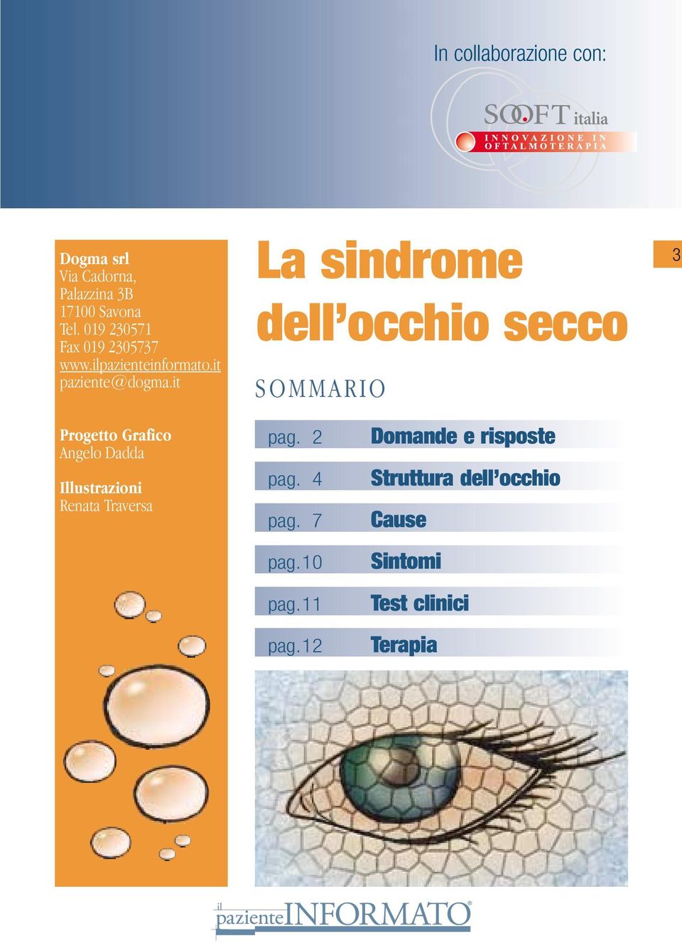it La sindrome dell occhio secco SOMMARIO 3 Progetto Grafico Angelo Dadda Illustrazioni