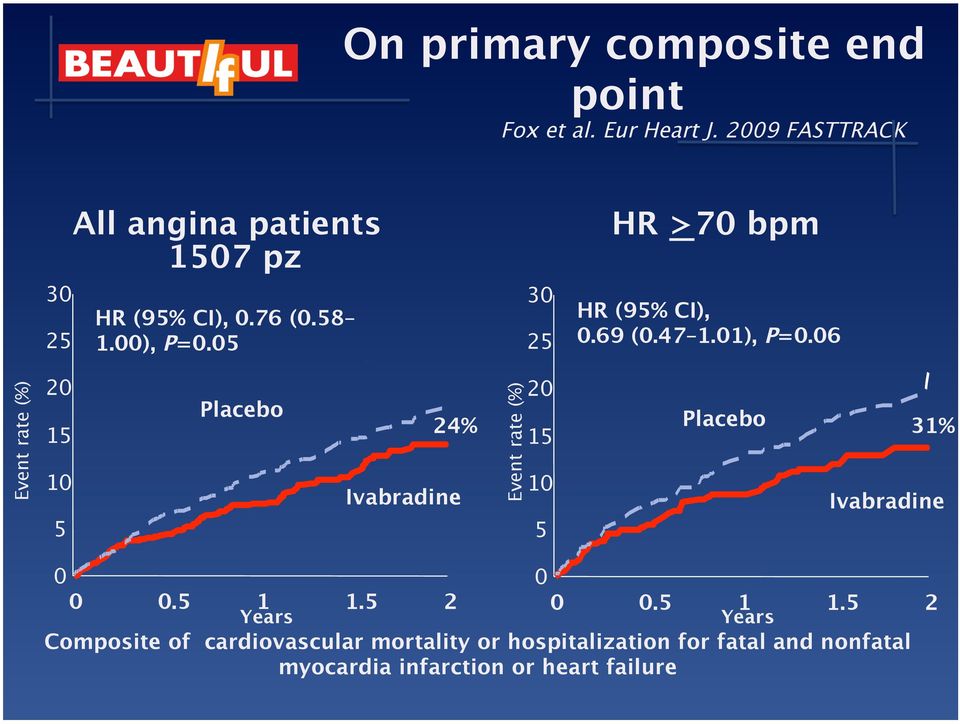 05 Placebo Ivabradine 30 25 10 5 HR (95% CI), 0.69 (0.47 1.01), P=0.