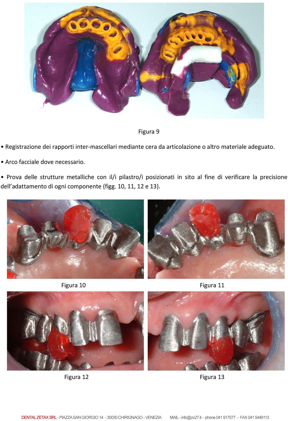 Prova delle strutture metalliche con il/i pilastro/i posizionati in sito al fine di