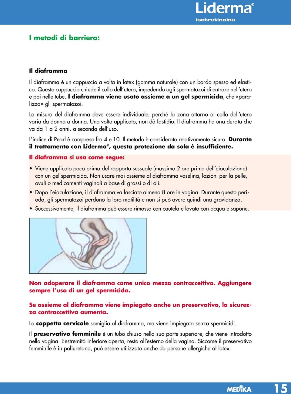 La misura del diaframma deve essere individuale, perché la zona attorno al collo dell utero varia da donna a donna. Una volta applicato, non dà fastidio.