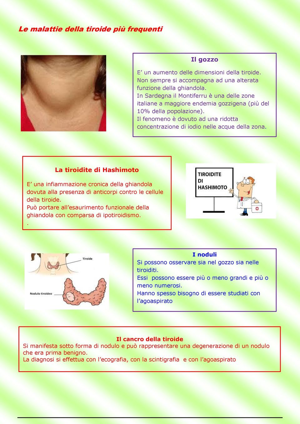 La tiroidite di Hashimoto E una infiammazione cronica della ghiandola dovuta alla presenza di anticorpi contro le cellule della tiroide.