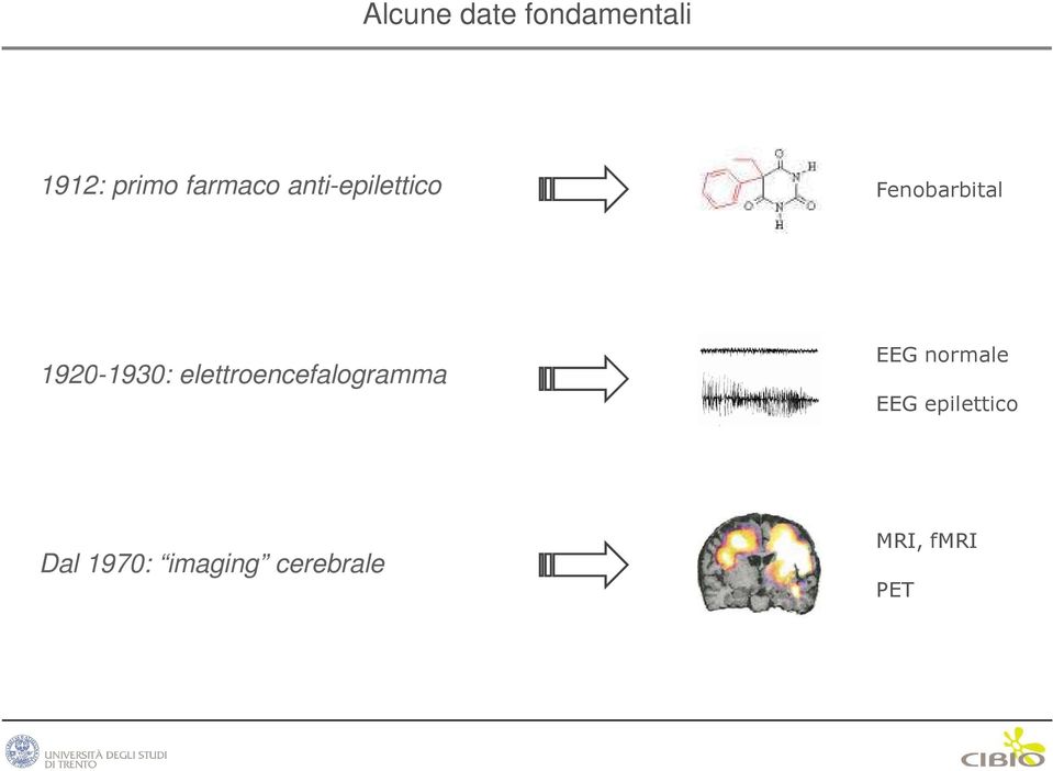 elettroencefalogramma EEG normale EEG