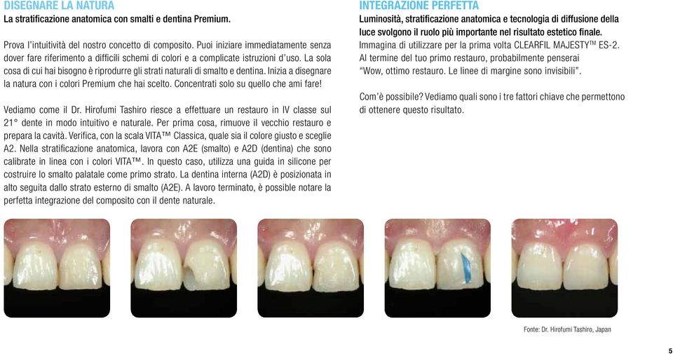 La sola cosa di cui hai bisogno è riprodurre gli strati naturali di smalto e dentina. Inizia a disegnare la natura con i colori Premium che hai scelto. Concentrati solo su quello che ami fare!