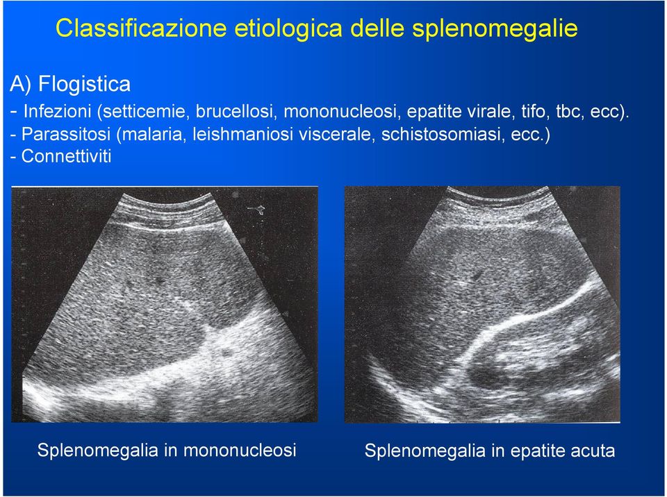 - Parassitosi (malaria, leishmaniosi viscerale, schistosomiasi, ecc.