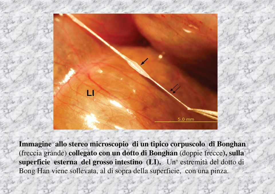 sulla superficie esterna del grosso intestino (LI).