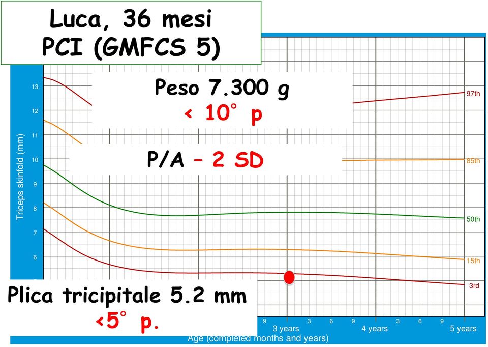 50th 7 6 15th 5 Plica tricipitale 5.2 mm 4 <5 p.