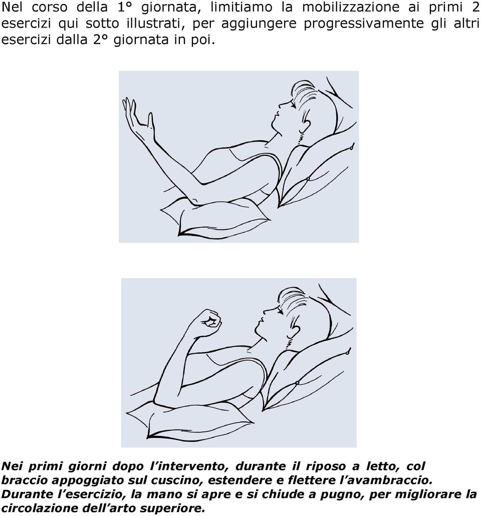 Nei primi giorni dopo l intervento, durante il riposo a letto, col braccio appoggiato sul cuscino,