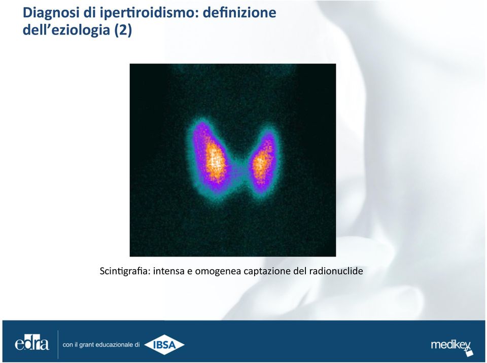 eziologia (2) Scin'grafia: