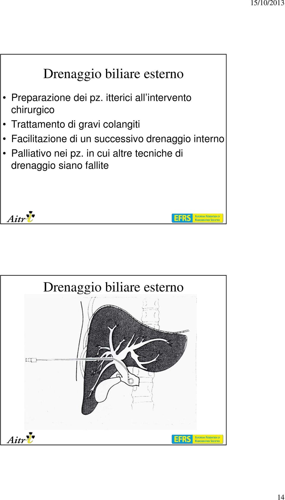 colangiti Facilitazione di un successivo drenaggio interno