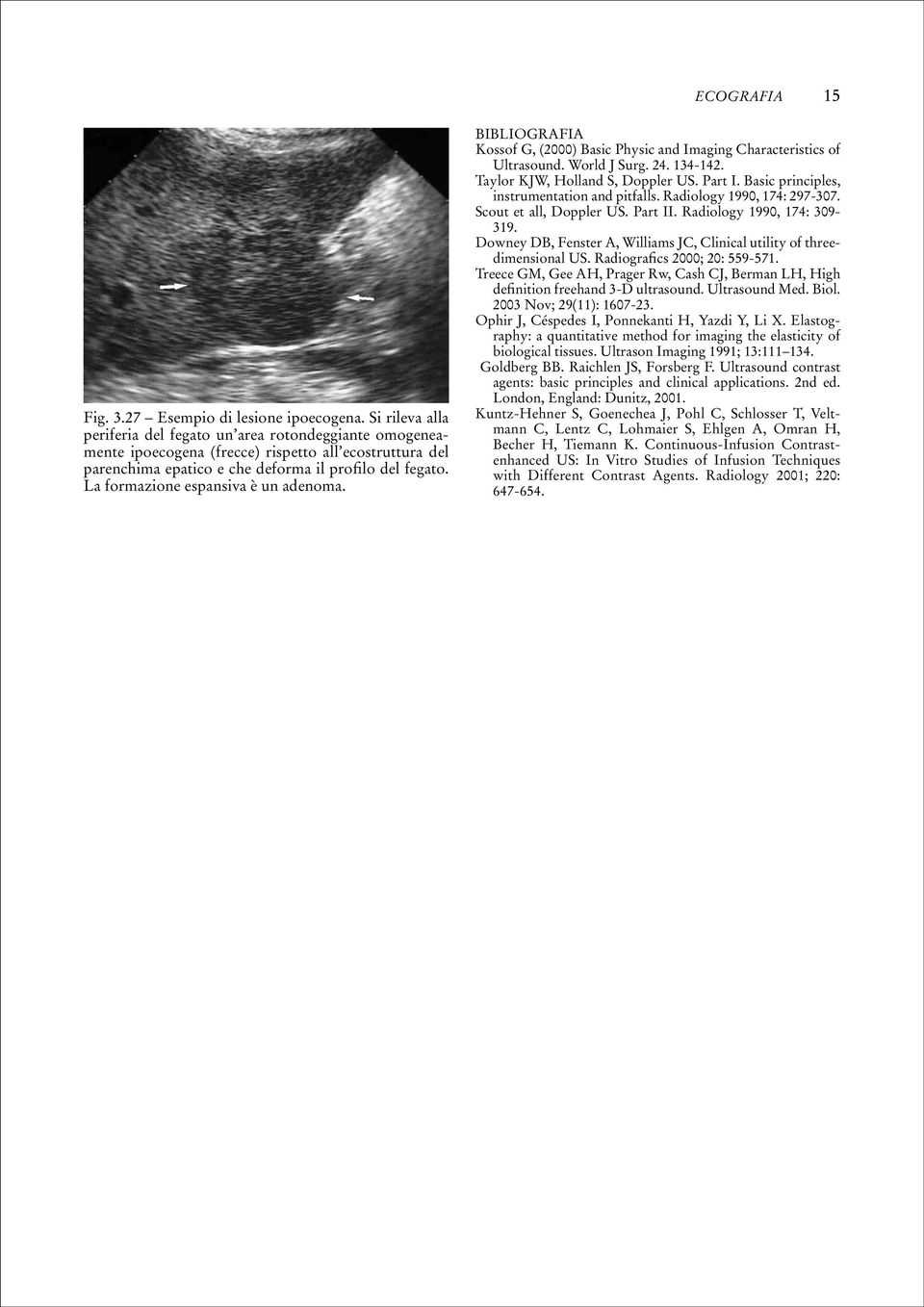 La formazione espansiva è un adenoma. Bibliografia Kossof G, (2000) Basic Physic and Imaging Characteristics of Ultrasound. World J Surg. 24. 134-142. Taylor KJW, Holland S, Doppler US. Part I.