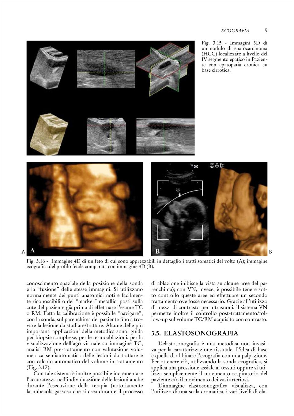 Per ottenere ciò, utilizzando la sonda ecografica, si applica una pressione assiale ai tessuti oppure si utilizza semplicemente il movimento respiratorio del paziente e/o il movimento dei vasi