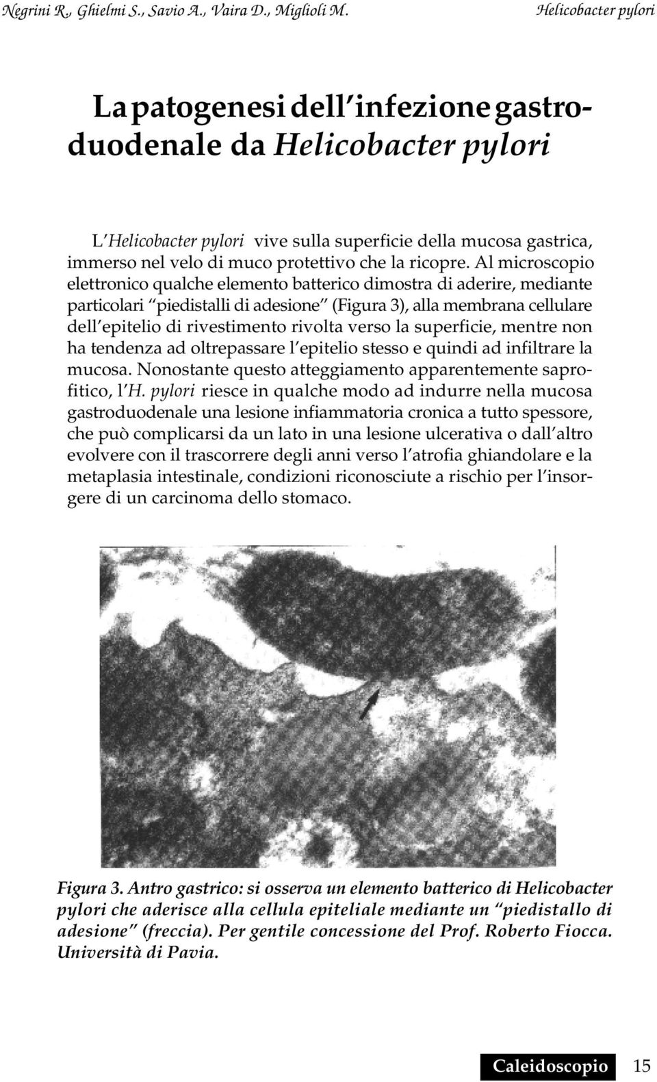 la superficie, mentre non ha tendenza ad oltrepassare l epitelio stesso e quindi ad infiltrare la mucosa. Nonostante questo atteggiamento apparentemente saprofitico, l H.