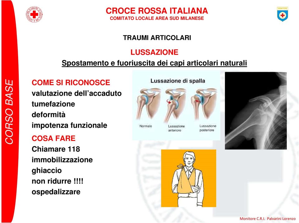 accaduto tumefazione deformità impotenza funzionale COSA FARE