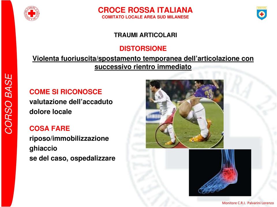 COME SI RICONOSCE valutazione dell accaduto dolore locale COSA