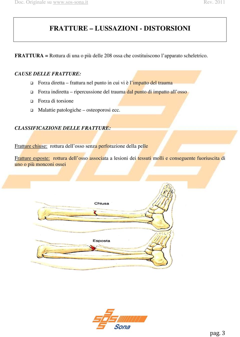 impatto all osso Forza di torsione Malattie patologiche osteoporosi ecc.