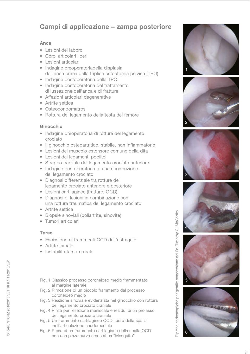 legamento della testa del femore 1 Ginocchio Indagine preoperatoria di rotture del legamento crociato Il ginocchio osteoartritico, stabile, non infiammatorio Lesioni del muscolo estensore comune