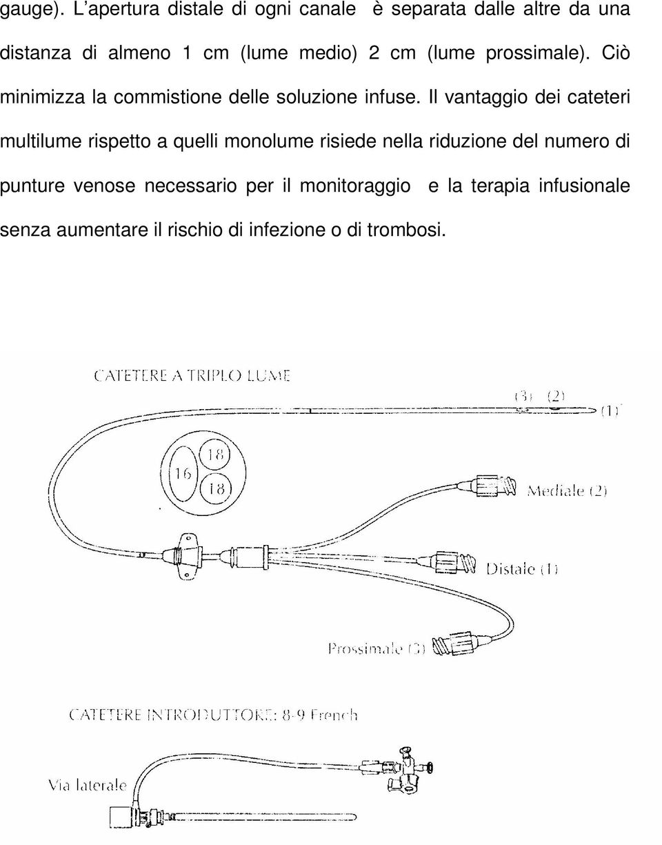 cm (lume prossimale). Ciò minimizza la commistione delle soluzione infuse.