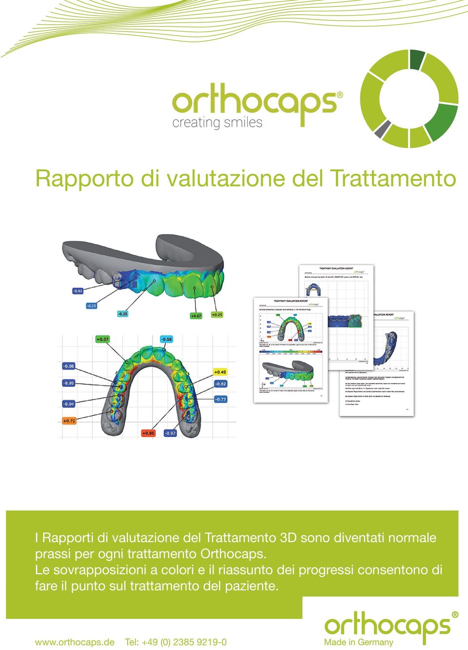 Le sovrapposizioni a colori e il riassunto dei progressi consentono di fare