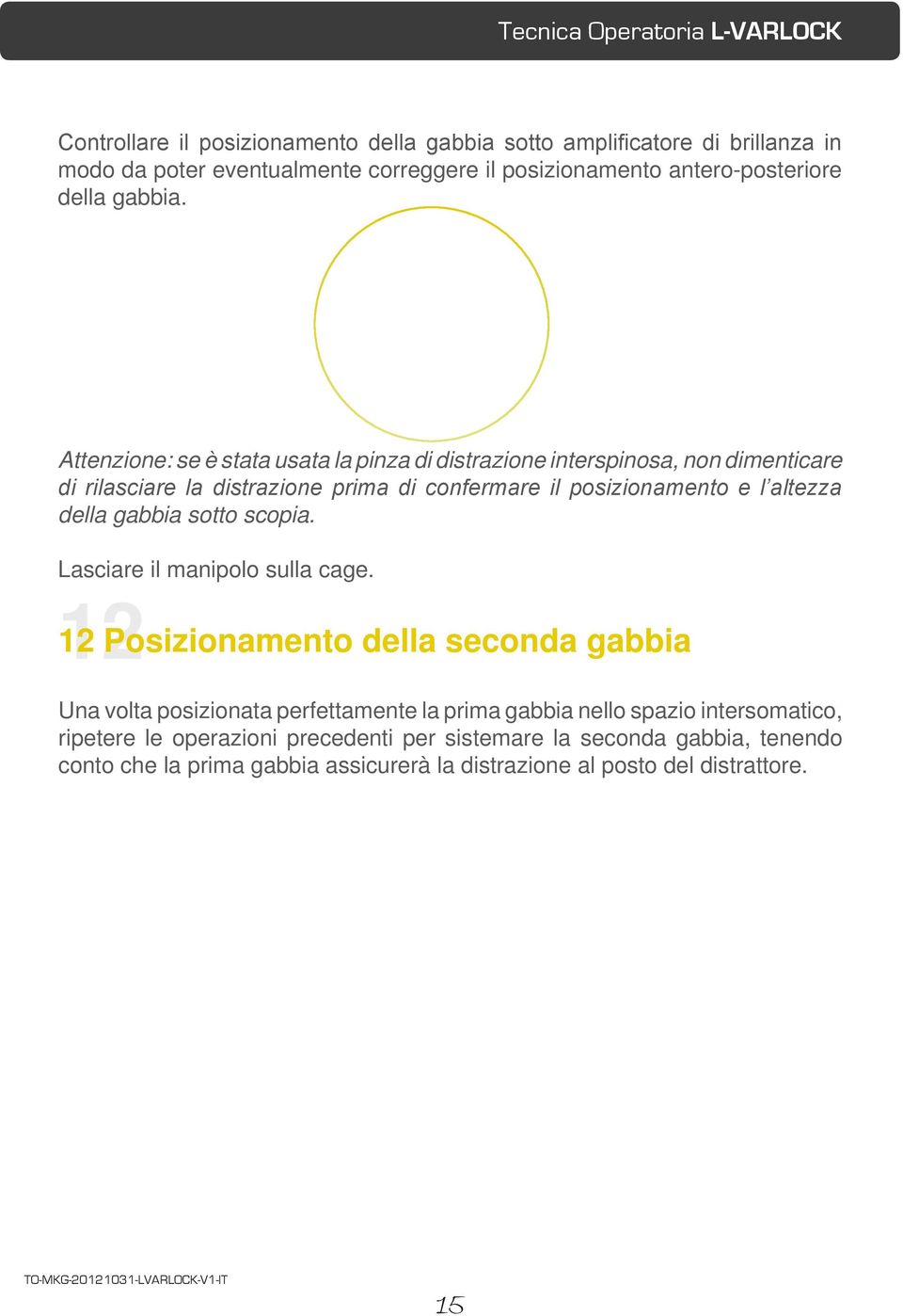 Attenzione: se è stata usata la pinza di distrazione interspinosa, non dimenticare di rilasciare la distrazione prima di confermare il posizionamento e l altezza